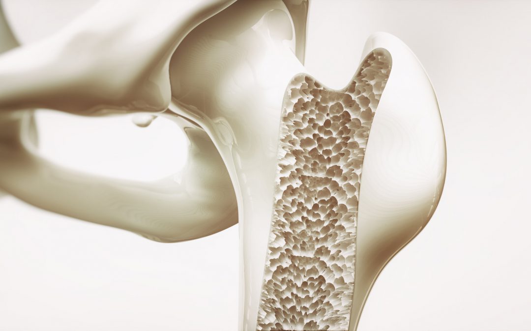 Osteoporoza: Lečenje uz matične ćelije u eri regenerativne medicine