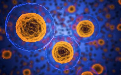 Šta je lupus i kako matične ćelije mogu da pomognu u lečenju?
