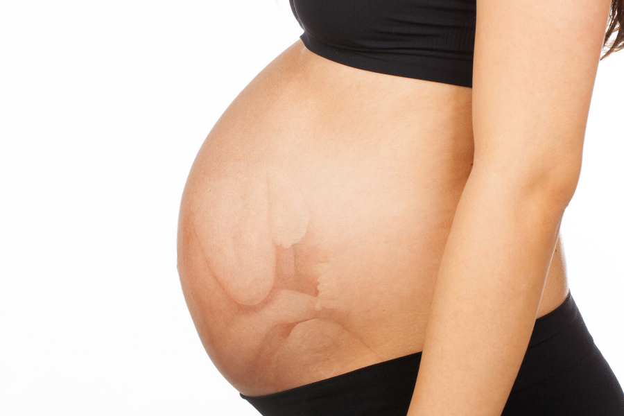 Položaj bebe u stomaku tokom trudnoće